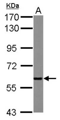 Western Blot: XIAP Antibody [NBP2-20918]