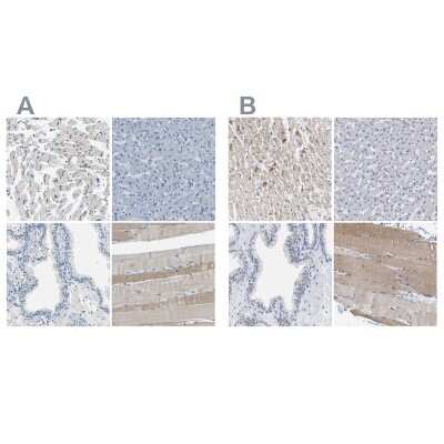 Immunohistochemistry-Paraffin: XIRP1 Antibody [NBP1-85529]
