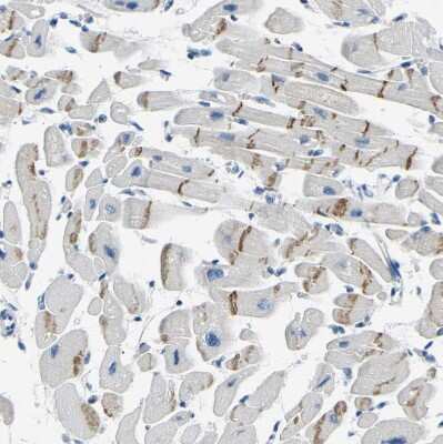 Immunohistochemistry-Paraffin: XIRP1 Antibody [NBP1-85529]