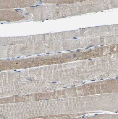 Immunohistochemistry-Paraffin: XIRP1 Antibody [NBP1-85529]