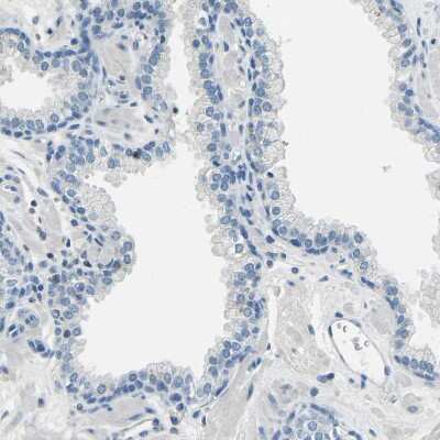 Immunohistochemistry-Paraffin: XIRP1 Antibody [NBP1-85529]