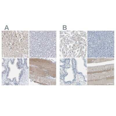 Immunohistochemistry-Paraffin: XIRP1 Antibody [NBP1-85530]