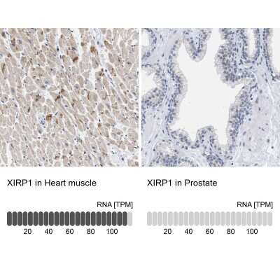Immunohistochemistry-Paraffin: XIRP1 Antibody [NBP1-85530]