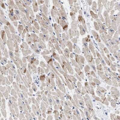 Immunohistochemistry-Paraffin: XIRP1 Antibody [NBP1-85530]