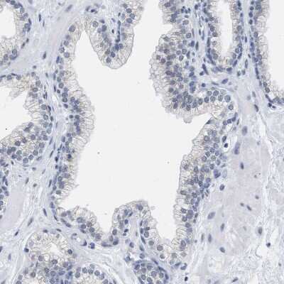 Immunohistochemistry-Paraffin: XIRP1 Antibody [NBP1-85530]