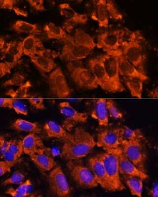 Immunocytochemistry/ Immunofluorescence: XK X-linked Kx blood group Antibody - Azide and BSA Free [NBP2-93011]