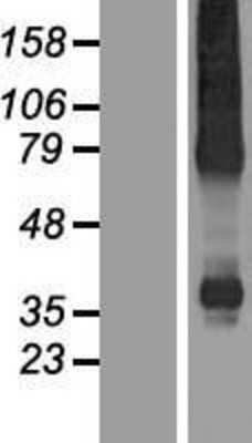 Western Blot: XK X-linked Kx blood group Overexpression Lysate [NBP2-06566]