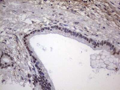Immunohistochemistry: XLF Antibody (OTI1B5) [NBP2-46163]