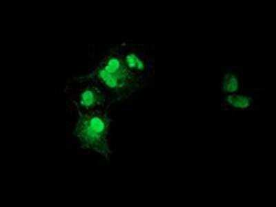 Immunocytochemistry/ Immunofluorescence: XLF Antibody (OTI3D6) [NBP2-03275]