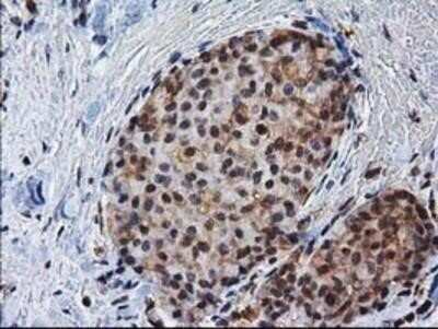 Immunohistochemistry: XLF Antibody (OTI3D6) - Azide and BSA Free [NBP2-74876]