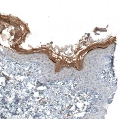 Immunohistochemistry-Paraffin: XP32 Antibody [NBP1-93557]