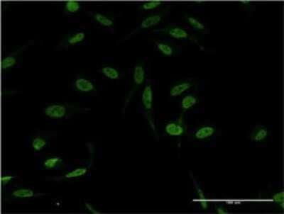 Immunocytochemistry/ Immunofluorescence: XPA Antibody (2E4) [H00007507-M01]