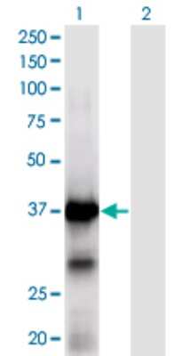 Western Blot: XPA Antibody (2E4) [H00007507-M01]