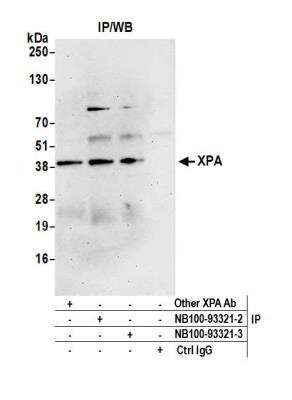 Immunoprecipitation: XPA Antibody [NB100-93321]