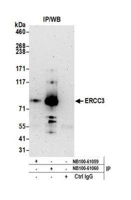 Immunoprecipitation: XPB Antibody [NB100-61060]