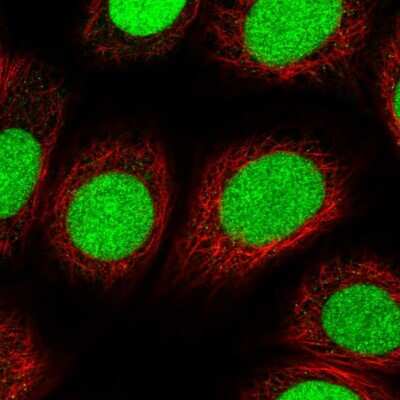 Immunocytochemistry/ Immunofluorescence: XPC Antibody [NBP2-38261]