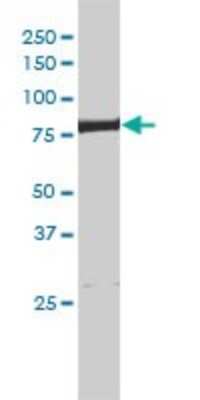 Western Blot: XPD Antibody (4G2-2A6) [H00002068-M01]