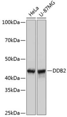 Western Blot: XPE/DDB2 Antibody (4Y2G5) [NBP3-15414]