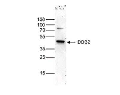 Western Blot: XPE/DDB2 Antibody (C.15200222) [NBP2-62792]