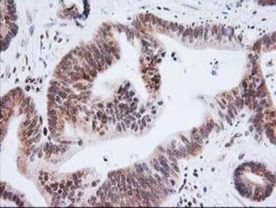 Immunohistochemistry-Paraffin: XPF Antibody (OTI4E11) [NBP2-01020]