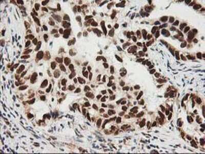 Immunohistochemistry-Paraffin: XPF Antibody (OTI4E11) [NBP2-01020]
