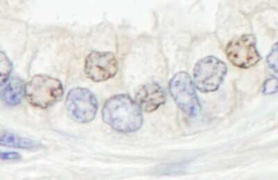 Immunohistochemistry-Paraffin: XPF Antibody [NB100-60679]