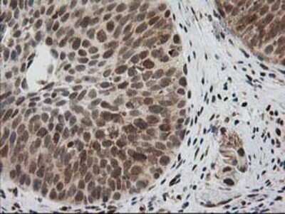 Immunohistochemistry: XPF Antibody (OTI4E11) - Azide and BSA Free [NBP2-74883]