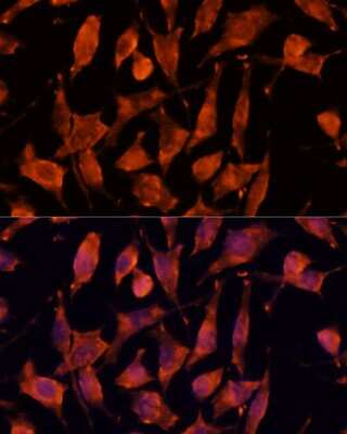 Immunocytochemistry/ Immunofluorescence: XPNPEP3 Antibody - Azide and BSA Free [NBP2-93838]