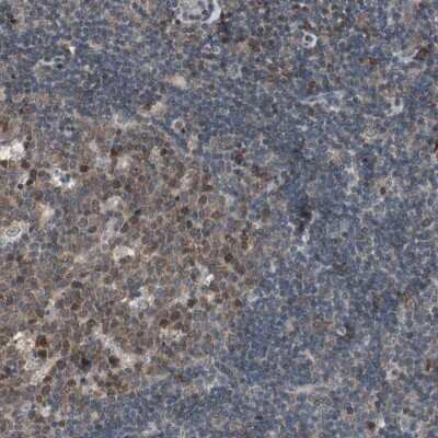 Immunohistochemistry-Paraffin: XPV/DNA polymerase eta Antibody [NBP1-87165]