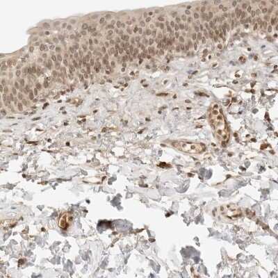 Immunohistochemistry-Paraffin: XPV/DNA polymerase eta Antibody [NBP1-87166]