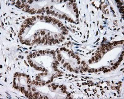 Immunohistochemistry-Paraffin: XRCC1 Antibody (OTI2F8) [NBP2-02280]