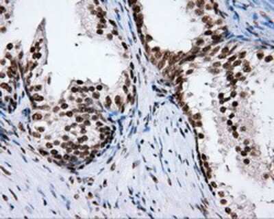 Immunohistochemistry-Paraffin: XRCC1 Antibody (OTI2F8) [NBP2-02280]