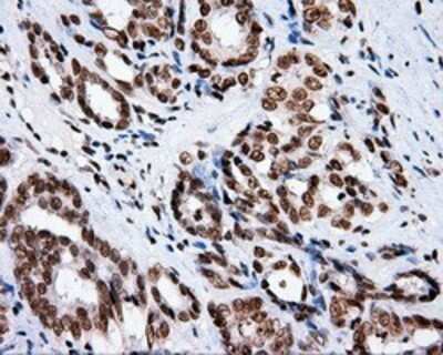 Immunohistochemistry: XRCC1 Antibody (OTI2F8) - Azide and BSA Free [NBP2-74891]