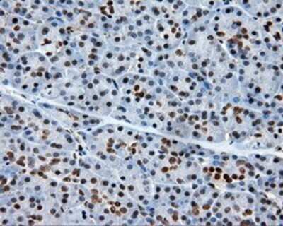 Immunohistochemistry: XRCC1 Antibody (OTI2F8) - Azide and BSA Free [NBP2-74891]