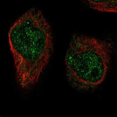 Immunocytochemistry/ Immunofluorescence: XRCC3 Antibody [NBP2-56545]