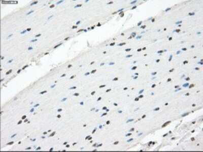 Immunohistochemistry: XRCC4 Antibody (OTI4H9) - Azide and BSA Free [NBP2-74896]