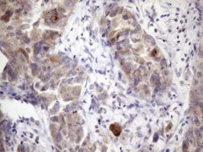 Immunohistochemistry: XRCC6BP1 Antibody (OTI5F3) [NBP2-46374]