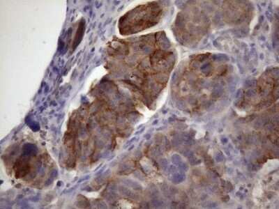 Immunohistochemistry: XRCC6BP1 Antibody (OTI5F3) - Azide and BSA Free [NBP2-74897]