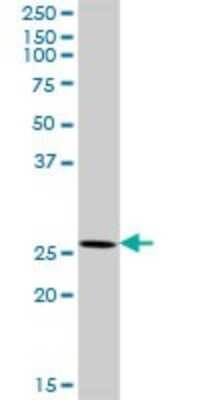 Western Blot: XRCC6BP1 Antibody [H00091419-D01P]