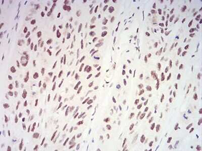 Immunohistochemistry: XRN2 Antibody (9F7G11) - BSA Free [NBP2-61839]