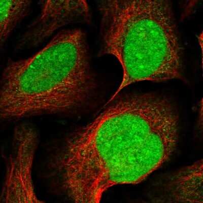 Immunocytochemistry/ Immunofluorescence: XRN2 Antibody [NBP2-13529]