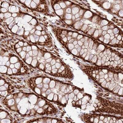 Immunohistochemistry-Paraffin: XRN2 Antibody [NBP2-13529]