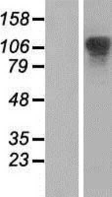 Western Blot: XRN2 Overexpression Lysate [NBP2-07470]