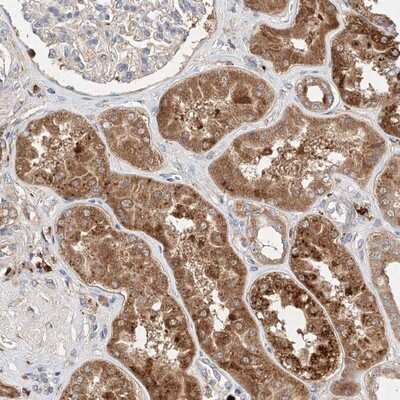 Immunohistochemistry-Paraffin: XTP12 Antibody [NBP1-90533]
