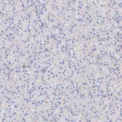 Immunohistochemistry-Paraffin: XTP12 Antibody [NBP1-90534]
