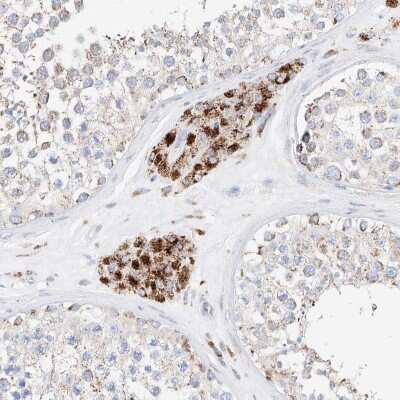 Immunohistochemistry-Paraffin: XTP12 Antibody [NBP1-90534]