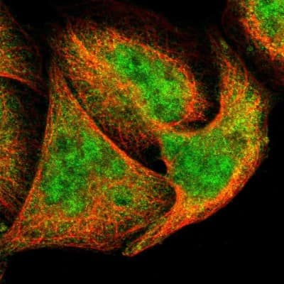 Immunocytochemistry/ Immunofluorescence: XTP3TPA Antibody [NBP1-85736]