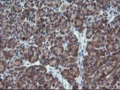Immunohistochemistry: XTP4 Antibody (OTI2D5) - Azide and BSA Free [NBP2-74904]