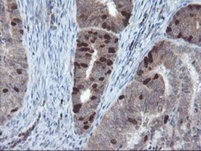 Immunohistochemistry: XTP4 Antibody (OTI2D5) [NBP2-46592]