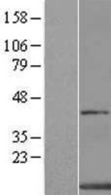 Western Blot: XTP4 Overexpression Lysate [NBL1-08232]